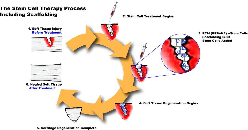 The Stem Cell Scaffolding Process